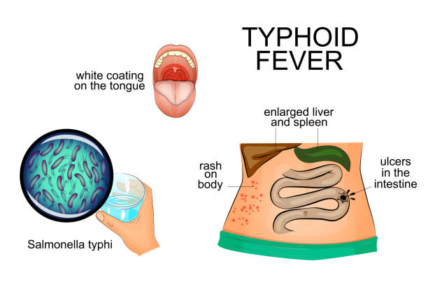 Can Fruit Tea Help Cure Typhoid Fever?, What Fruit Tea Is Good For Typhoid?, How To Make Fruit Tea For Typhoid At Home?